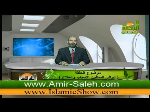 الطب الآمن (22) - دوالي الساقين الأسباب والعلاج